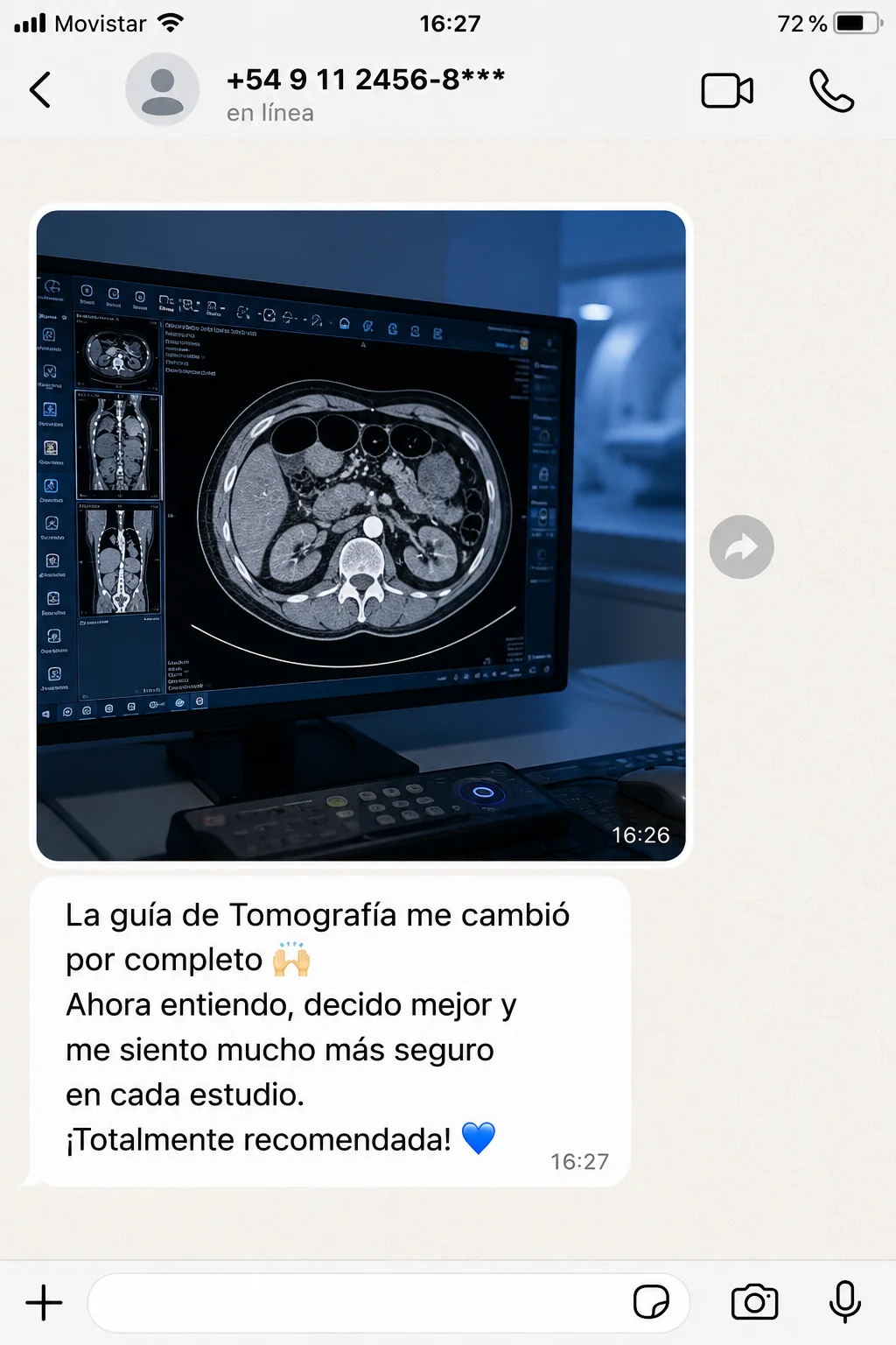 Mensaje de WhatsApp de un profesional recomendando la guía de tomografía (1 de 4)