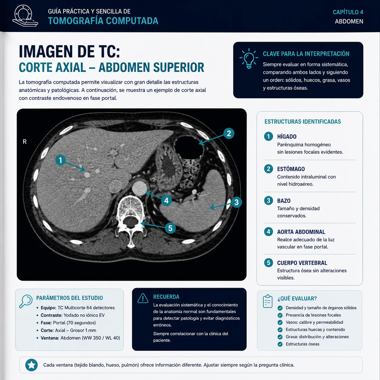 Imagen de TC: corte axial de abdomen superior